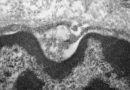 Novo coronavírus infecta e se replica em células das glândulas salivares